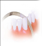 tira de striping doble acero inoxidable cara 4mm. pack 12 unidades
