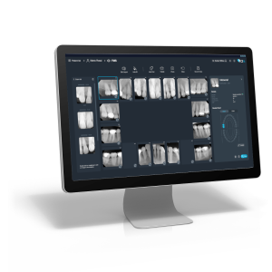 X-Mind Prime 2 - Imagen 3