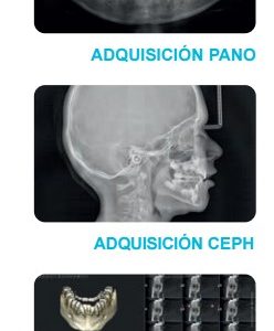 X-Mind Prime 2 - Imagen 6