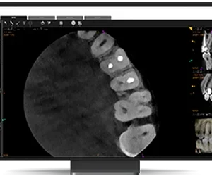 CS 8200 3D Access - Imagen 7