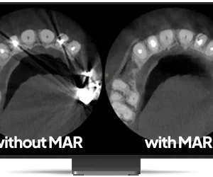 CS 8200 3D Access - Imagen 6