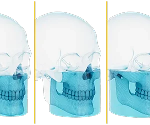 CS 8200 3D Advance Edition - Imagen 5