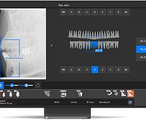 CS 8200 3D Advance Edition - Imagen 4
