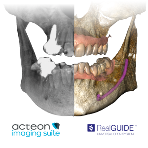 X-Mind Optima 3D - Imagen 5