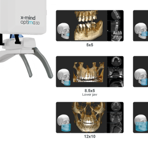X-Mind Optima 3D - Imagen 4
