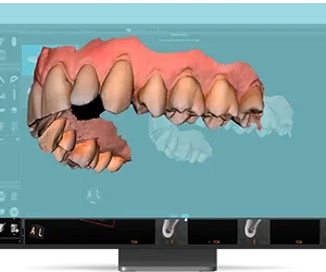 CS 8200 3D Access - Imagen 3