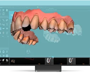 CS 8200 3D Advance Edition - Imagen 2