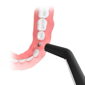 Implantmed Plus - Imagen 5