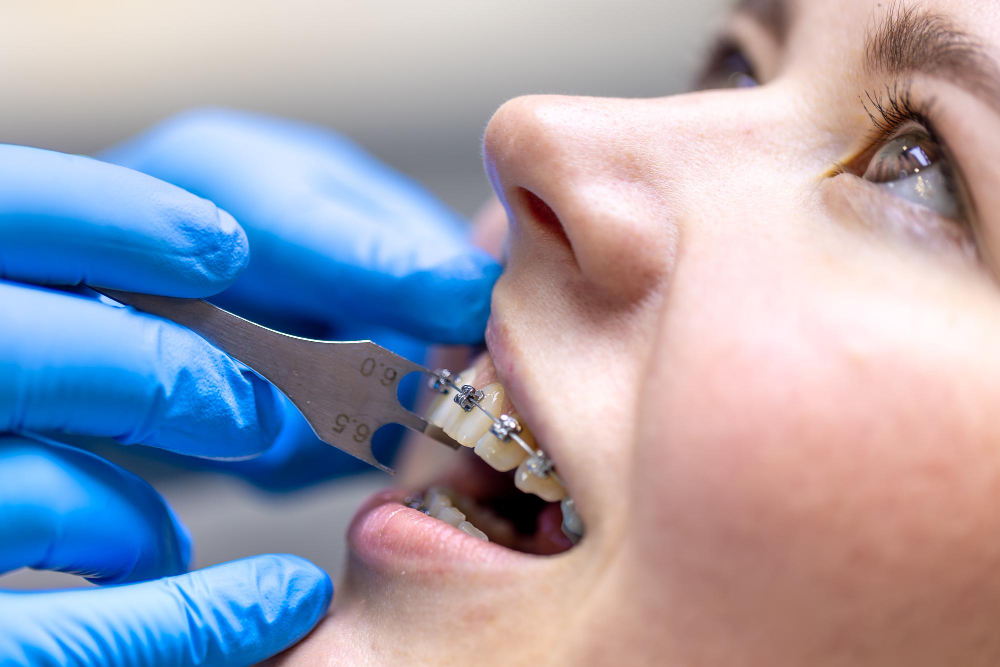 Equipos para Ortodoncia, deposito dental Zimadent